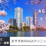 上野・日本橋・浅草のAGAクリニック25院を紹介！おすすめ掲載あり！